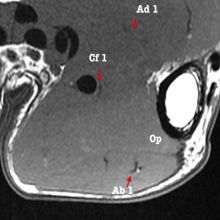 Anatomie Eminence Thenar